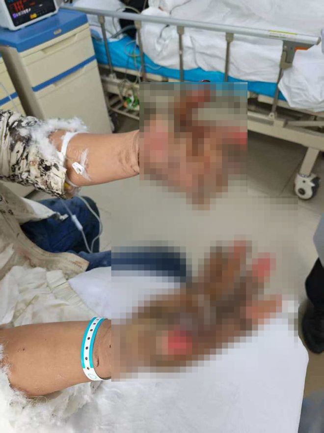 男子从着火电车救下3人未获评见义勇为 当地:系过错方