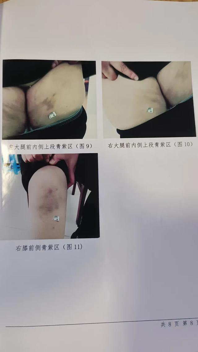 女子产子后50多天被丈夫施暴 母亲阻止被丈夫持刀威胁